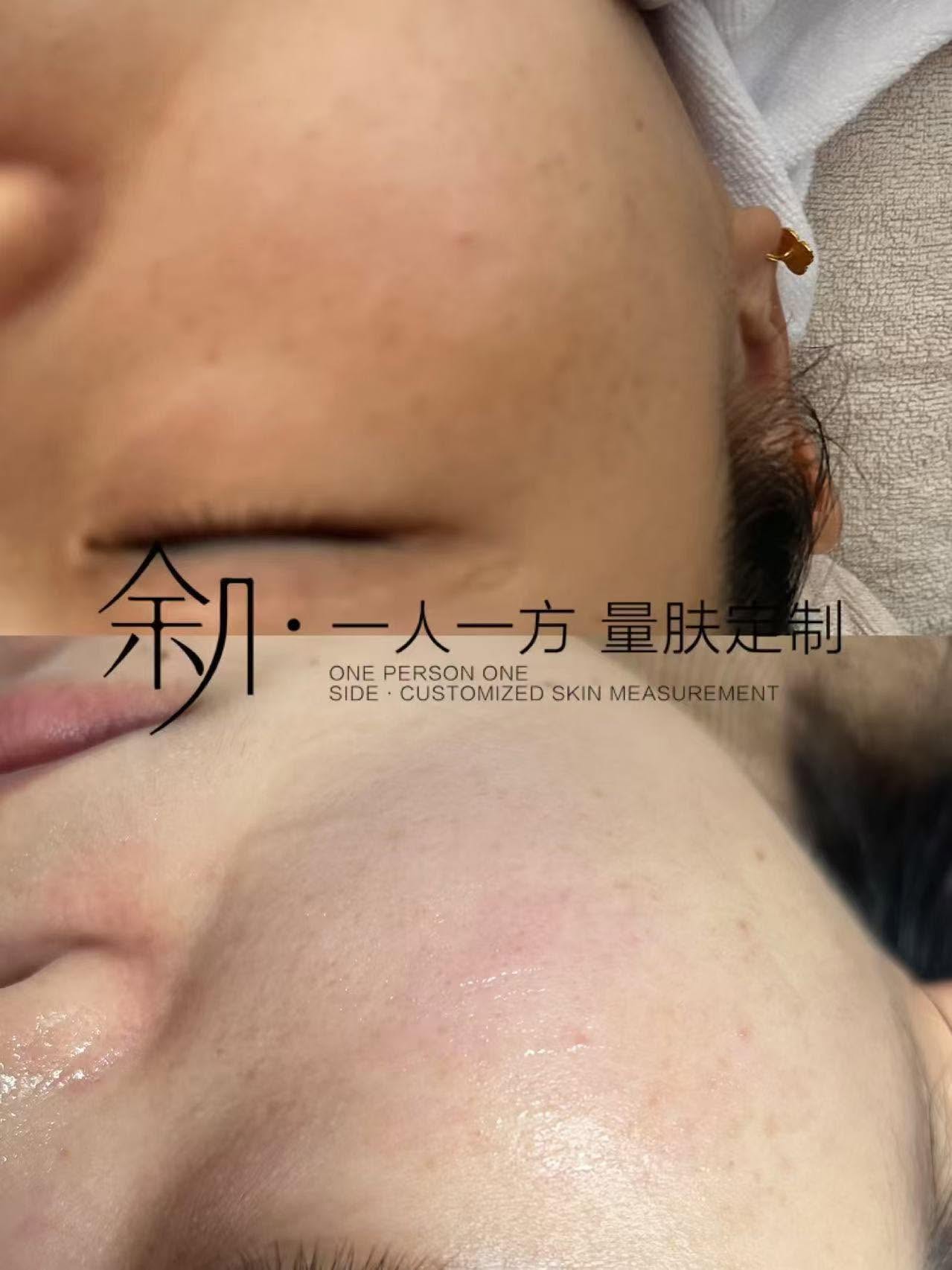 皮肤管理案例