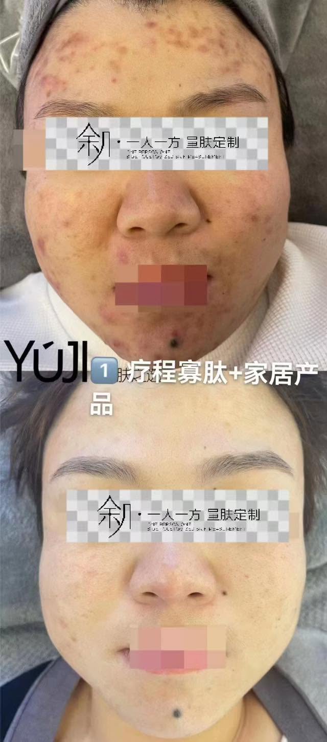 皮肤管理案例