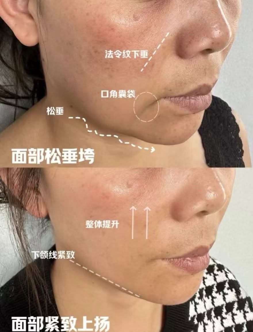 抗衰案例