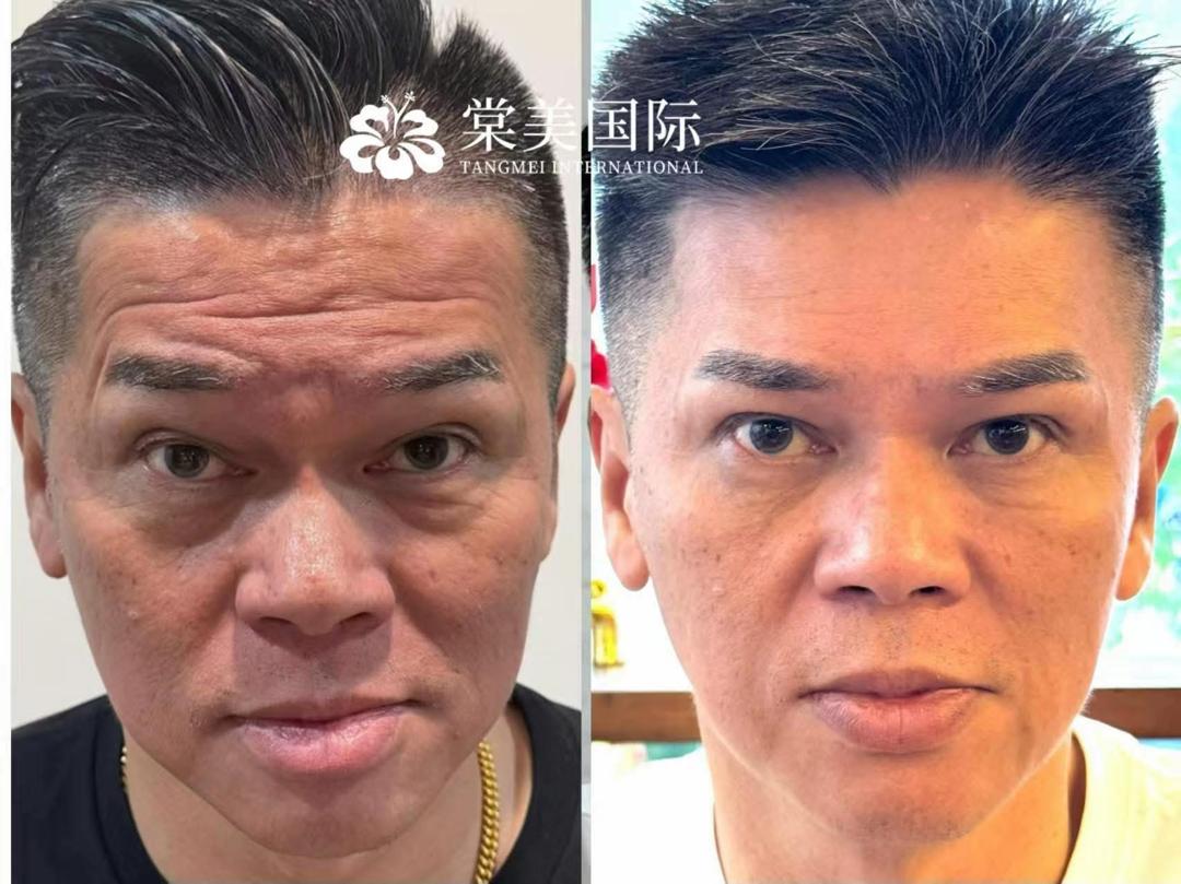 暗沉粗糙